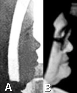 Lois Gibson – Forensic Art 2 Italian - Sister Lucy Truth